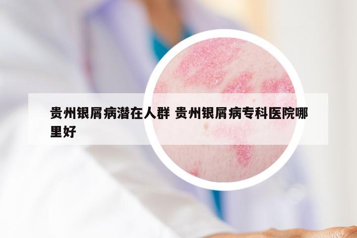 贵州银屑病潜在人群 贵州银屑病专科医院哪里好