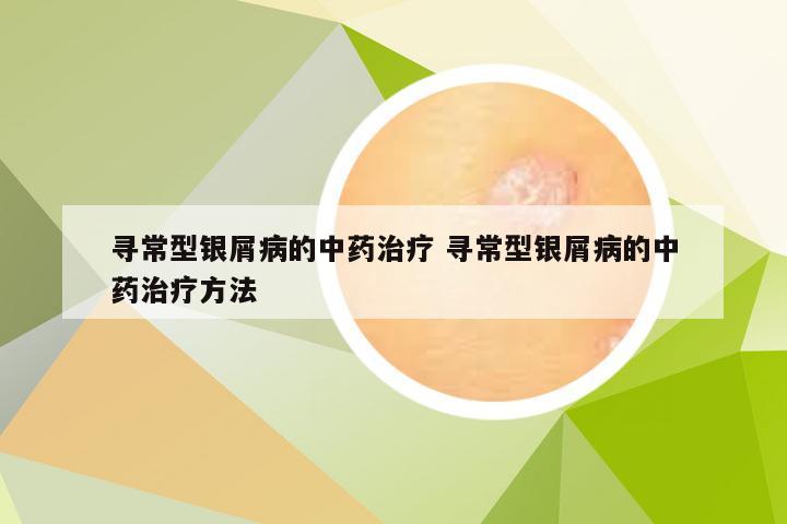 寻常型银屑病的中药治疗 寻常型银屑病的中药治疗方法