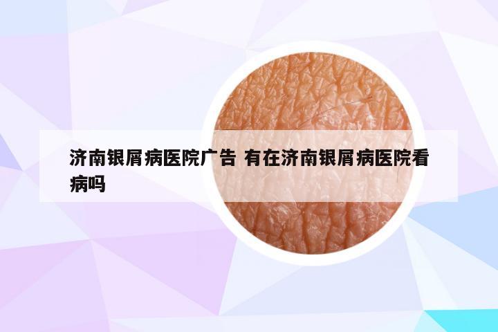 济南银屑病医院广告 有在济南银屑病医院看病吗
