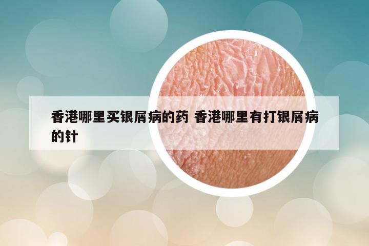 香港哪里买银屑病的药 香港哪里有打银屑病的针