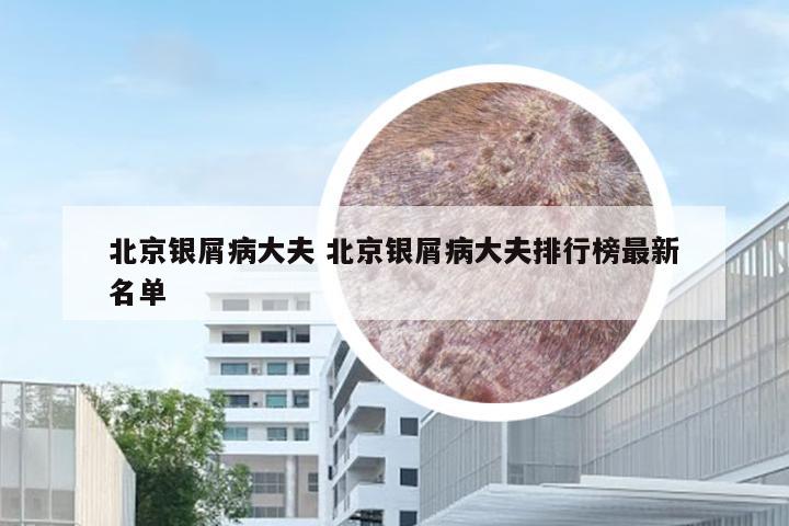 北京银屑病大夫 北京银屑病大夫排行榜最新名单