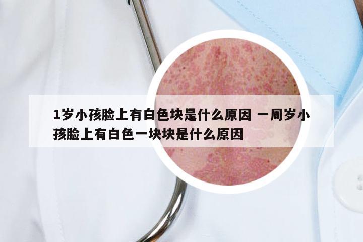 1岁小孩脸上有白色块是什么原因 一周岁小孩脸上有白色一块块是什么原因