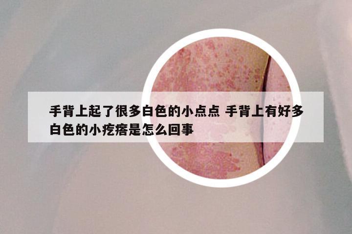 手背上起了很多白色的小点点 手背上有好多白色的小疙瘩是怎么回事