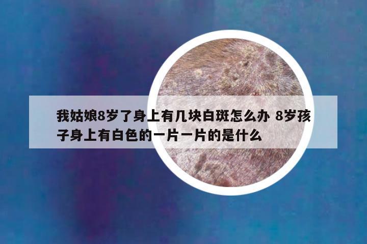我姑娘8岁了身上有几块白斑怎么办 8岁孩子身上有白色的一片一片的是什么