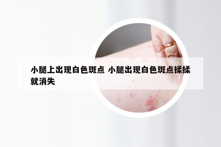 小腿上出现白色斑点 小腿出现白色斑点揉揉就消失