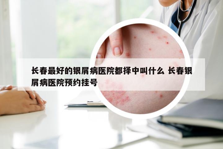 长春最好的银屑病医院都择中叫什么 长春银屑病医院预约挂号