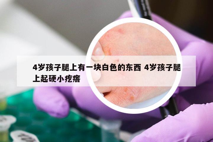 4岁孩子腿上有一块白色的东西 4岁孩子腿上起硬小疙瘩