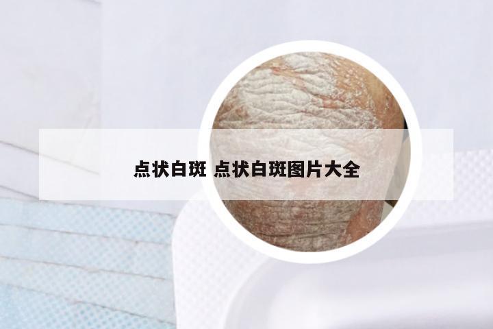 点状白斑 点状白斑图片大全