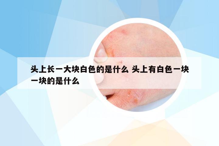 头上长一大块白色的是什么 头上有白色一块一块的是什么