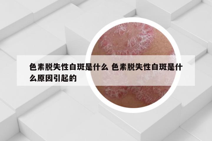 色素脱失性白斑是什么 色素脱失性白斑是什么原因引起的
