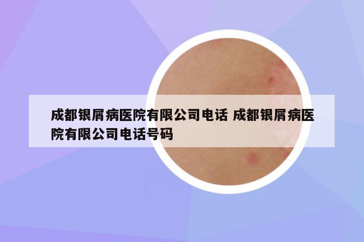 成都银屑病医院有限公司电话 成都银屑病医院有限公司电话号码