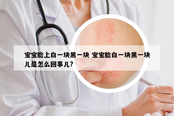 宝宝脸上白一块黑一块 宝宝脸白一块黑一块儿是怎么回事儿?