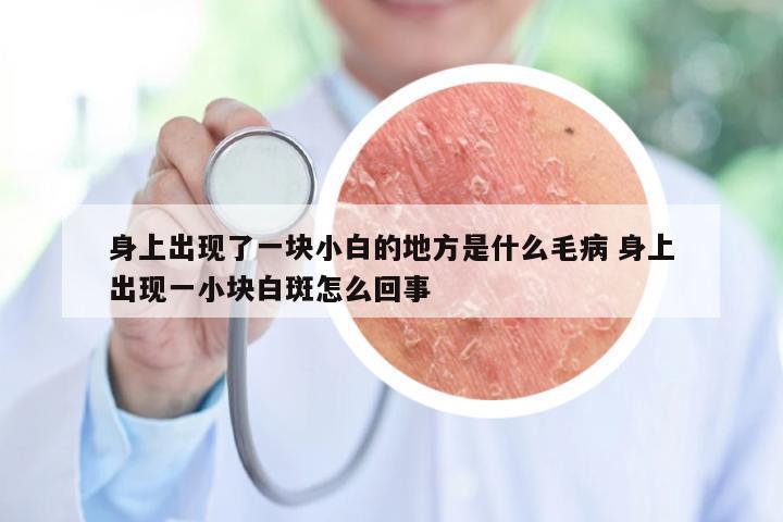 身上出现了一块小白的地方是什么毛病 身上出现一小块白斑怎么回事