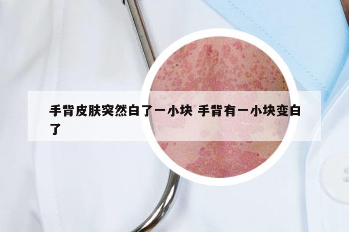 手背皮肤突然白了一小块 手背有一小块变白了