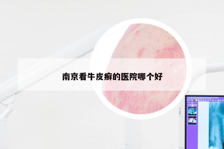 南京看牛皮癣的医院哪个好