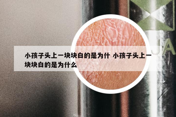 小孩子头上一块块白的是为什 小孩子头上一块块白的是为什么