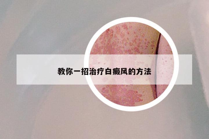 教你一招治疗白癜风的方法