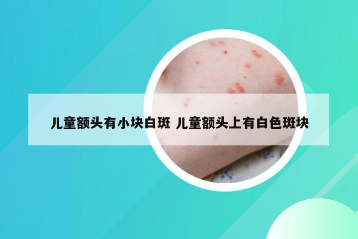 儿童额头有小块白斑 儿童额头上有白色斑块