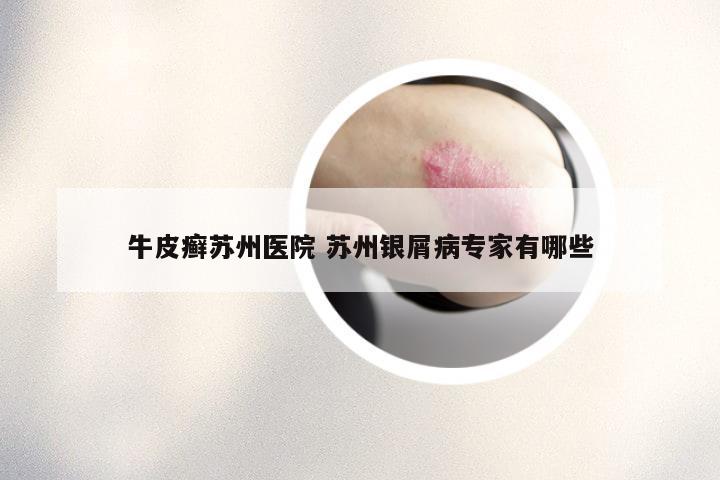 牛皮癣苏州医院 苏州银屑病专家有哪些