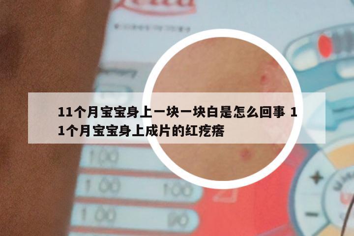 11个月宝宝身上一块一块白是怎么回事 11个月宝宝身上成片的红疙瘩