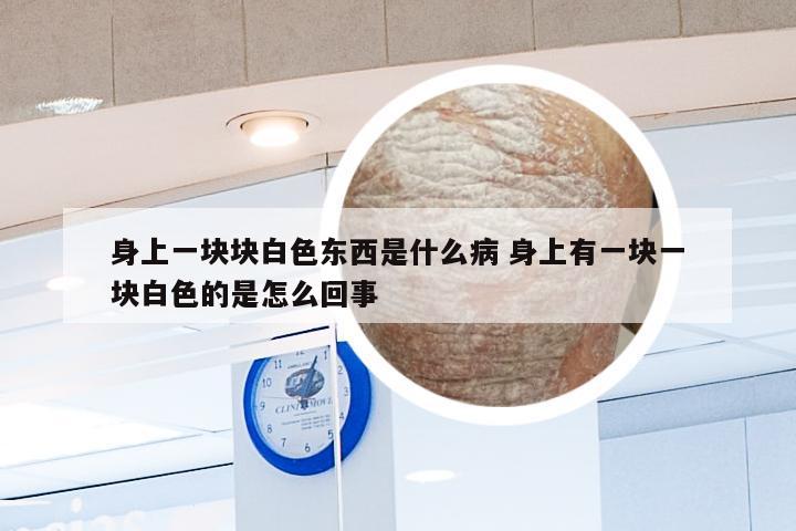 身上一块块白色东西是什么病 身上有一块一块白色的是怎么回事