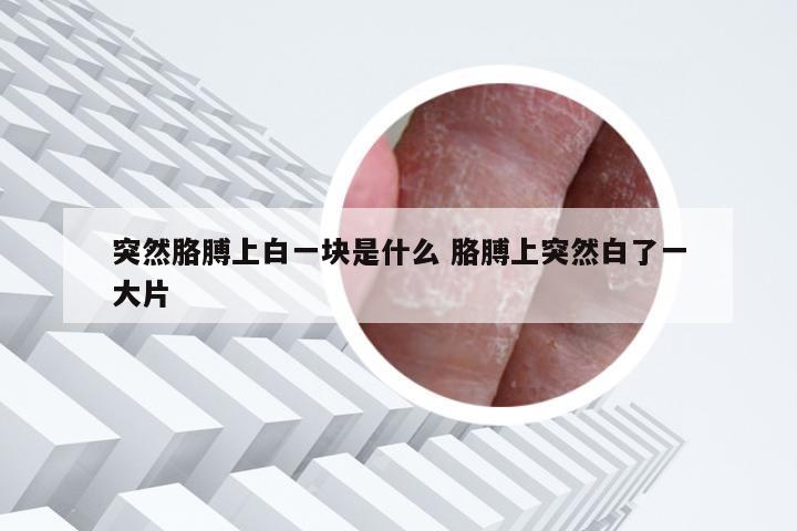 突然胳膊上白一块是什么 胳膊上突然白了一大片
