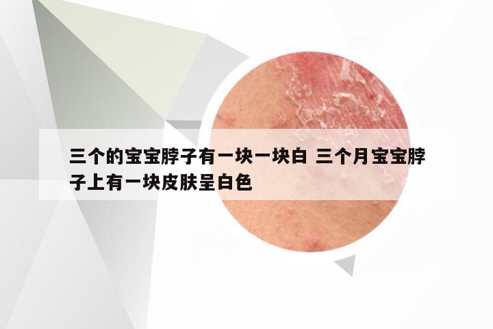 三个的宝宝脖子有一块一块白 三个月宝宝脖子上有一块皮肤呈白色