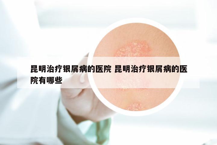 昆明治疗银屑病的医院 昆明治疗银屑病的医院有哪些