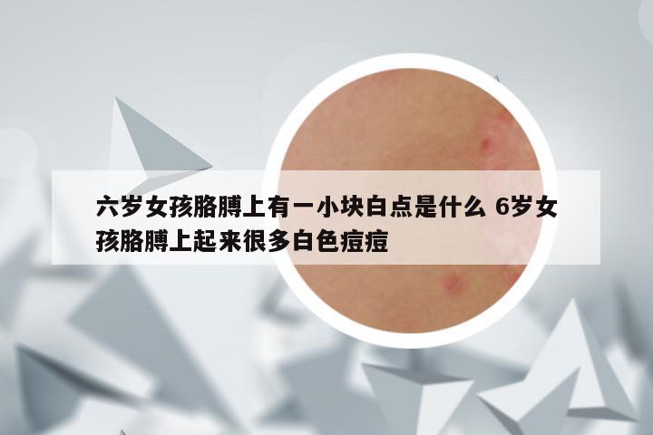 六岁女孩胳膊上有一小块白点是什么 6岁女孩胳膊上起来很多白色痘痘