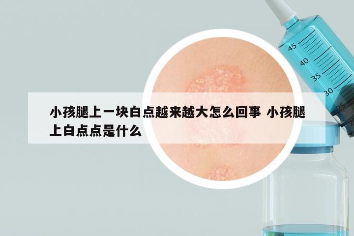 小孩腿上一块白点越来越大怎么回事 小孩腿上白点点是什么