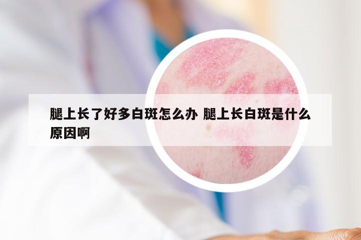 腿上长了好多白斑怎么办 腿上长白斑是什么原因啊