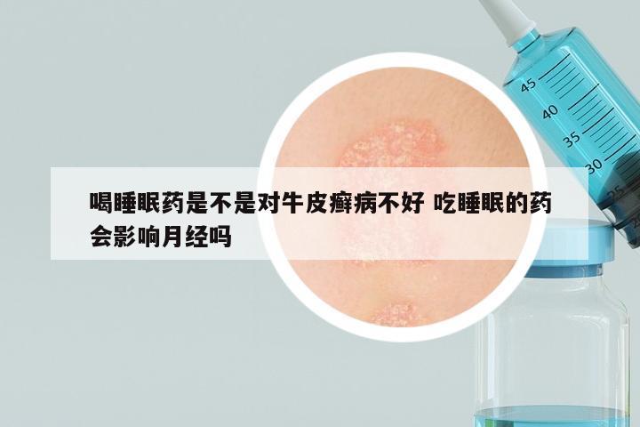 喝睡眠药是不是对牛皮癣病不好 吃睡眠的药会影响月经吗