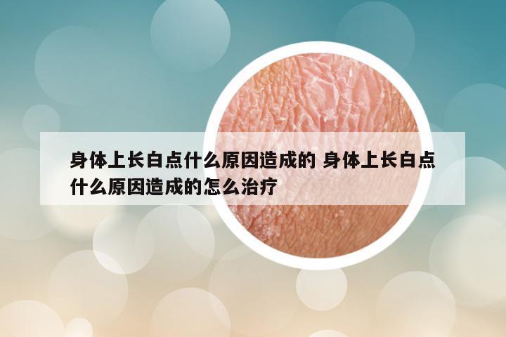 身体上长白点什么原因造成的 身体上长白点什么原因造成的怎么治疗