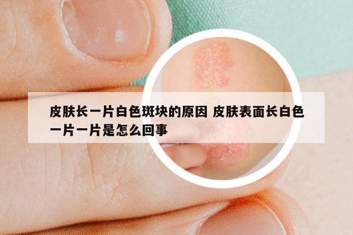 皮肤长一片白色斑块的原因 皮肤表面长白色一片一片是怎么回事
