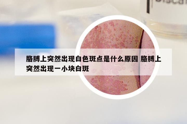 胳膊上突然出现白色斑点是什么原因 胳膊上突然出现一小块白斑