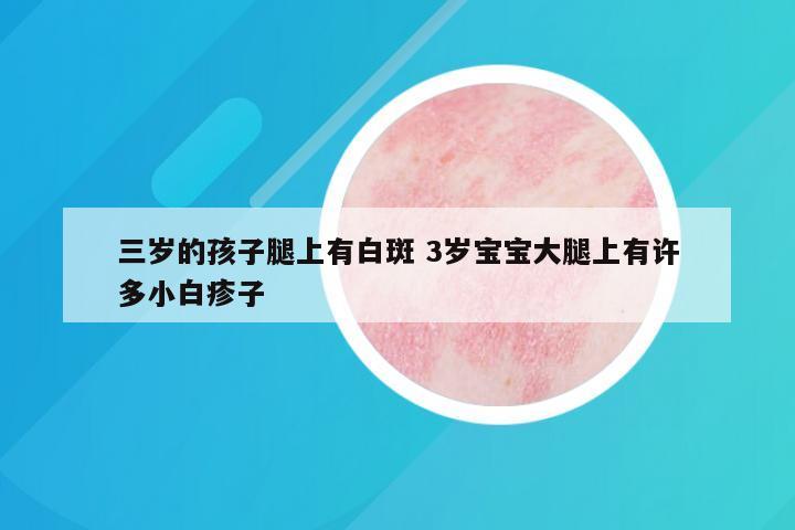 三岁的孩子腿上有白斑 3岁宝宝大腿上有许多小白疹子