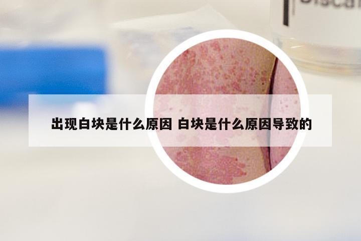 出现白块是什么原因 白块是什么原因导致的