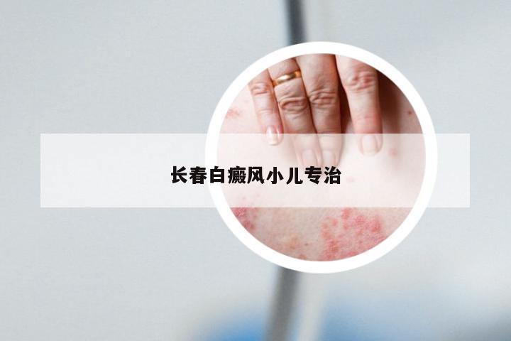 长春白癜风小儿专治