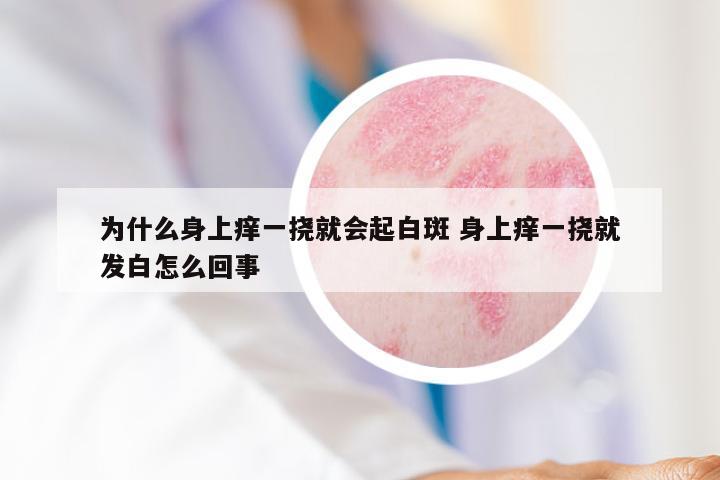 为什么身上痒一挠就会起白斑 身上痒一挠就发白怎么回事