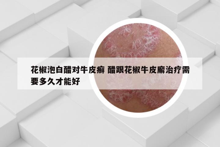 花椒泡白醋对牛皮癣 醋跟花椒牛皮廨治疗需要多久才能好