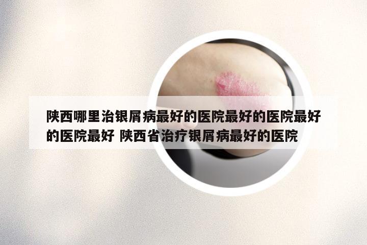 陕西哪里治银屑病最好的医院最好的医院最好的医院最好 陕西省治疗银屑病最好的医院
