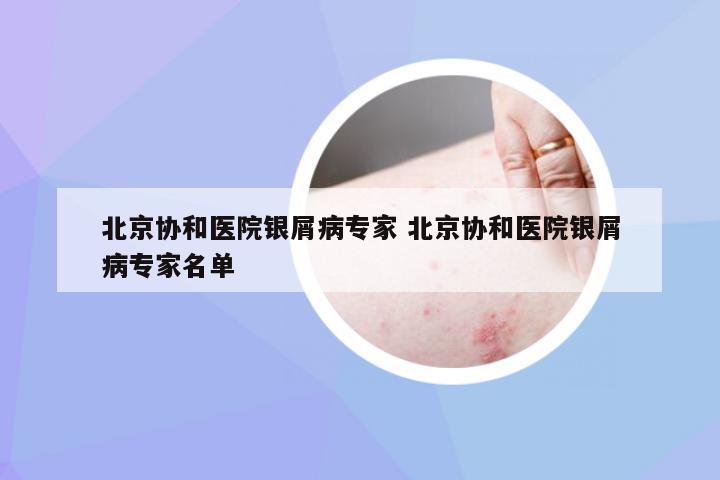 北京协和医院银屑病专家 北京协和医院银屑病专家名单