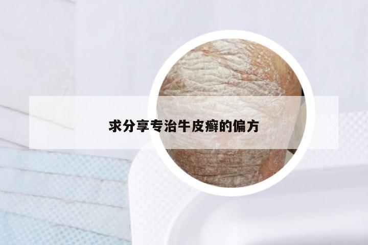 求分享专治牛皮癣的偏方