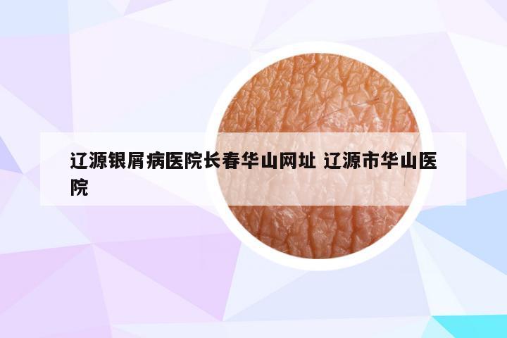 辽源银屑病医院长春华山网址 辽源市华山医院
