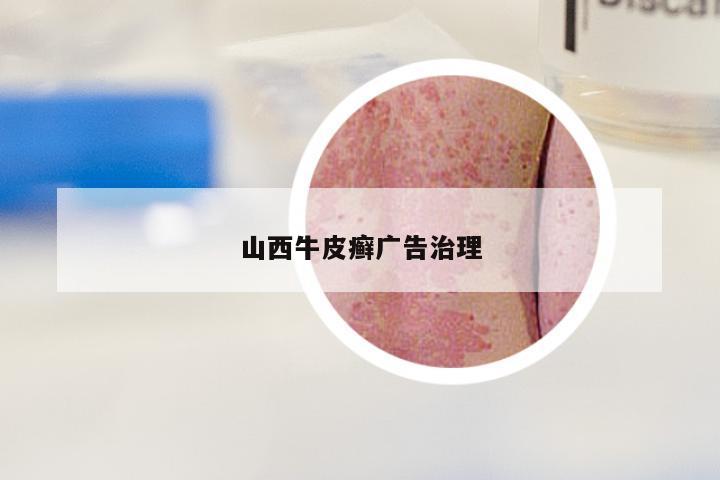山西牛皮癣广告治理