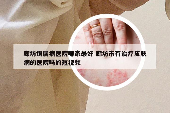 廊坊银屑病医院哪家最好 廊坊市有治疗皮肤病的医院吗的短视频