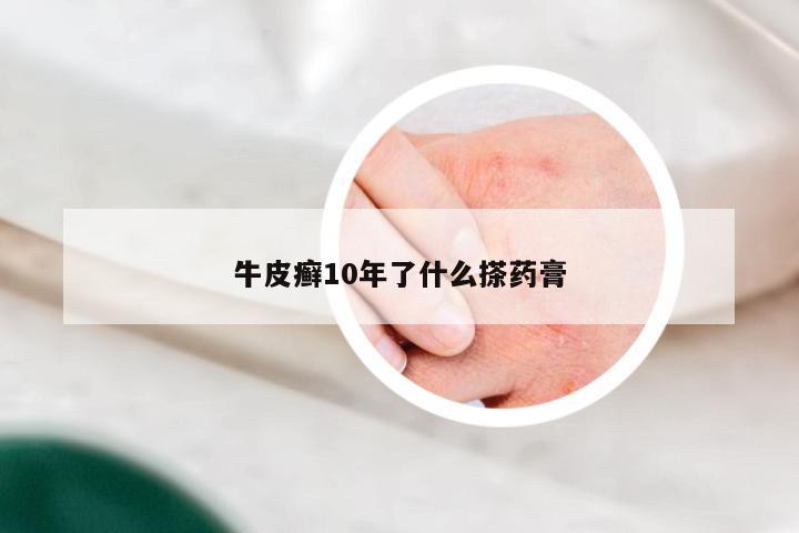 牛皮癣10年了什么搽药膏