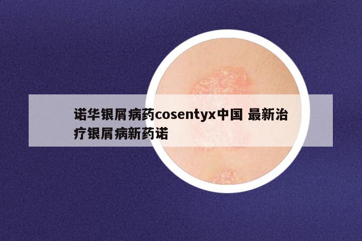 诺华银屑病药cosentyx中国 最新治疗银屑病新药诺