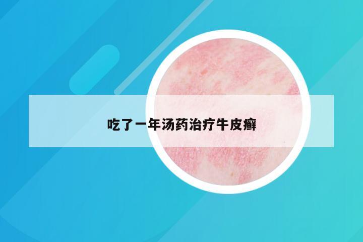 吃了一年汤药治疗牛皮癣