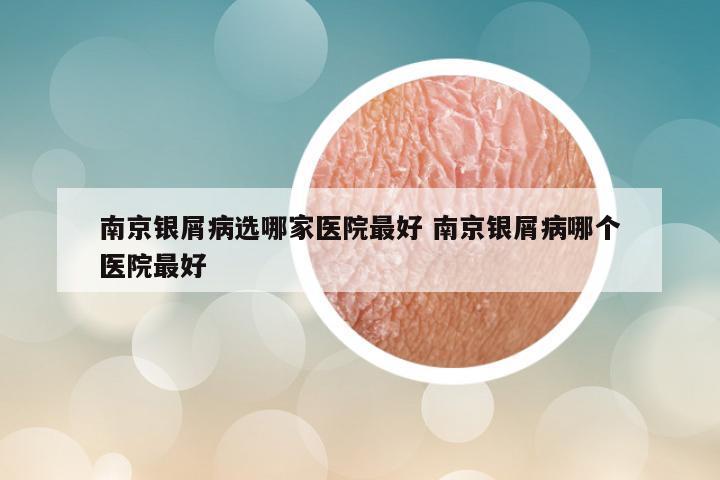 南京银屑病选哪家医院最好 南京银屑病哪个医院最好